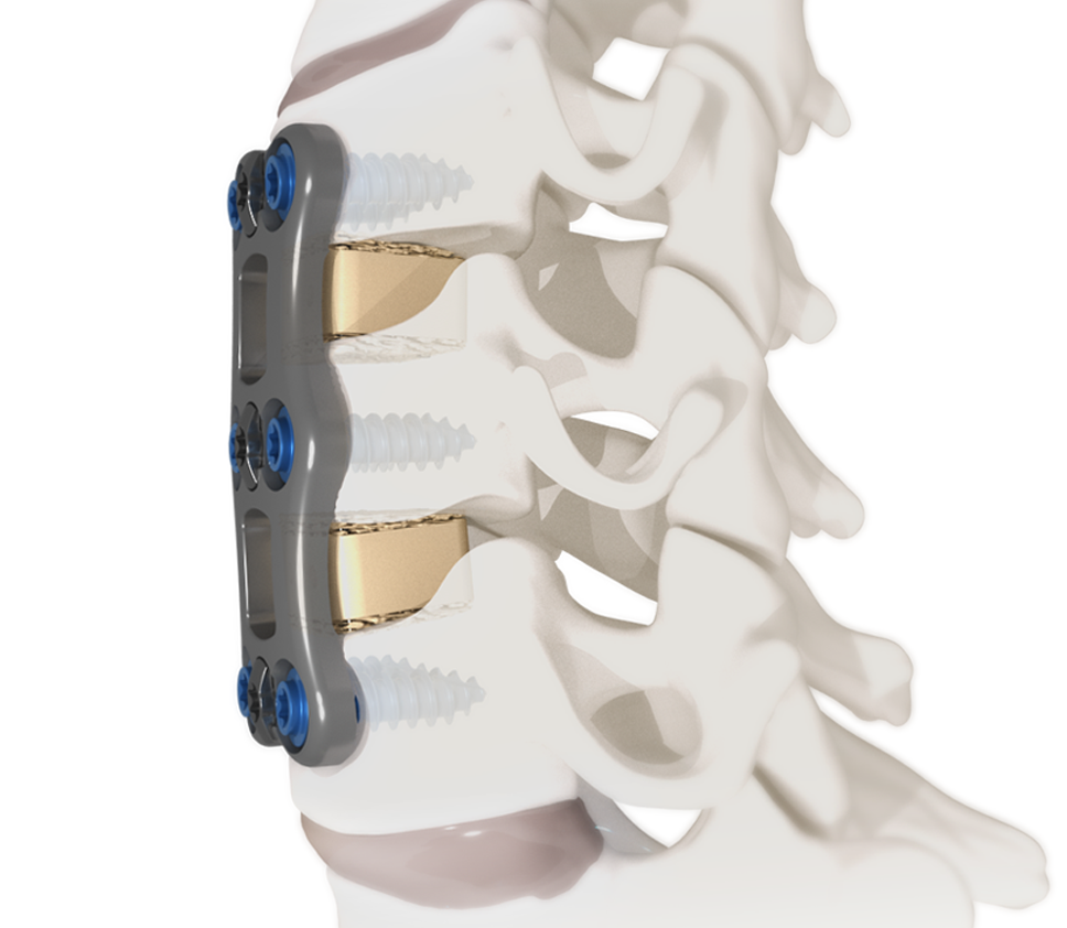 Cervical Spine